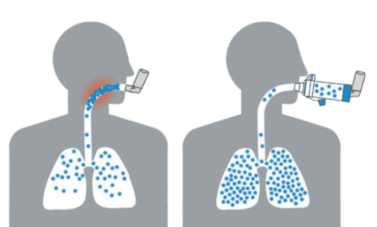 lungs inhaling with and without inhaler